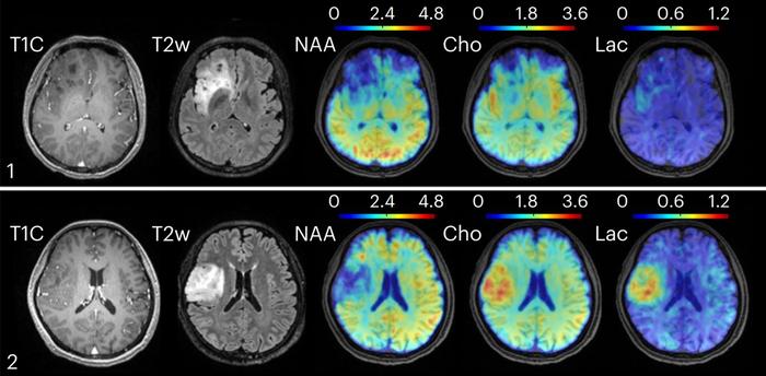 Metabolic MRI (IMAGE)