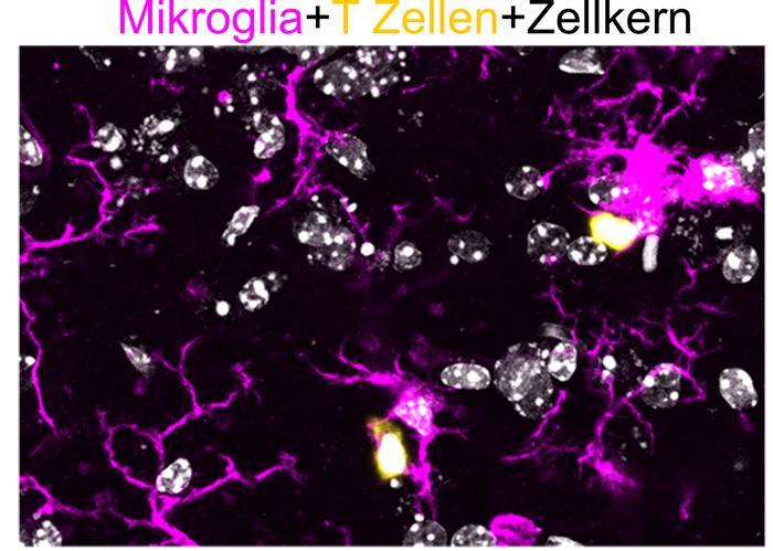 Low Res MikrolgiaundTZellen